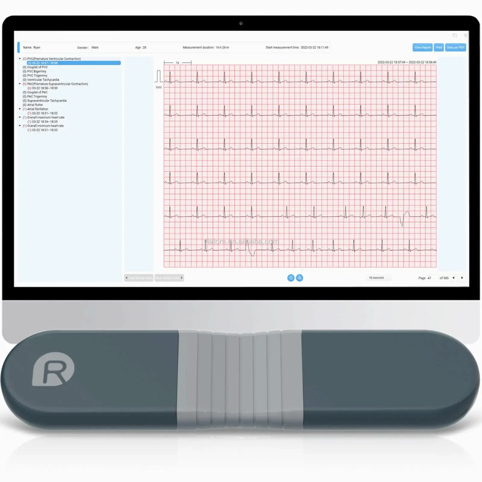 Kablosuz Bluetooth Dinamik Kay - Ecg Patch Monitor incelemesi ve fiyatı